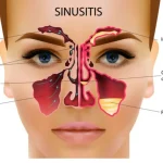 blocked nose and ears